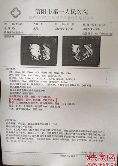 胎兒醫院四維彩超顯示一切正常 出生后肢體殘缺 胎兒醫院四維彩超顯示一切正常 出生后肢體殘缺