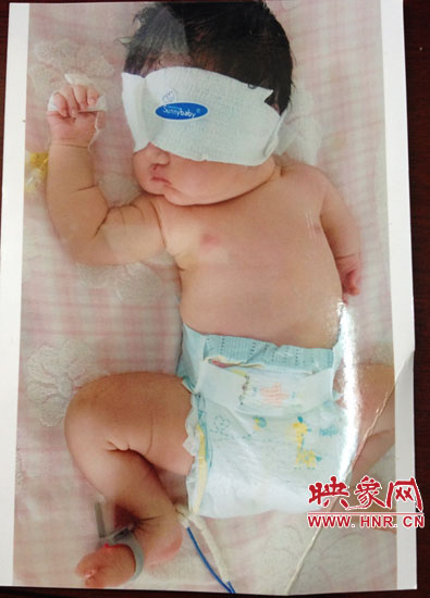 胎兒醫院四維彩超顯示一切正常 出生后肢體殘缺 胎兒醫院四維彩超顯示一切正常 出生后肢體殘缺
