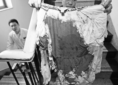 何女士的上衣被血浸透。記者楊濤攝 何女士的上衣被血浸透。記者楊濤攝