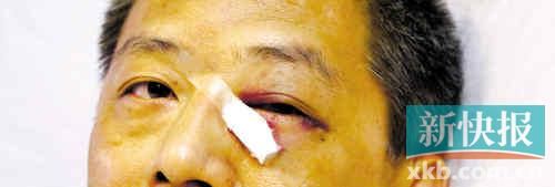 ■這起醫鬧事件，受傷的遠遠不只是熊旭明醫生的身體。