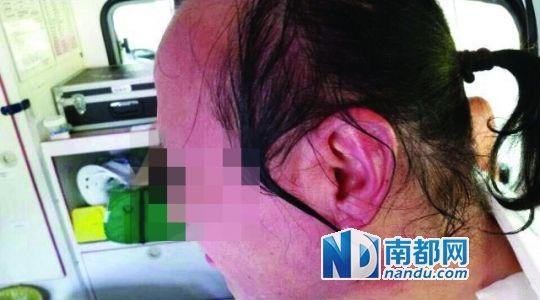 涉事教師遭熱水潑臉后的照片。