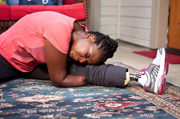 愛美媽媽整形導致截肢 愛美媽媽整形導致截肢