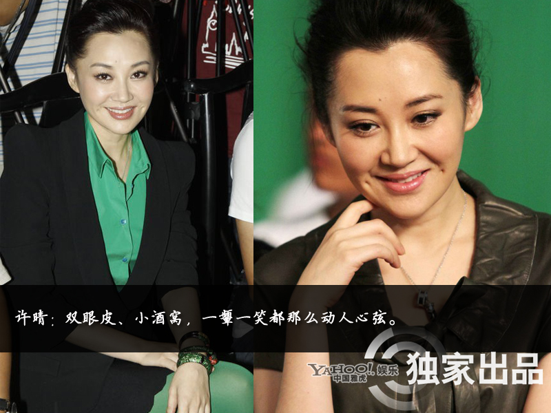 娛樂圈整容成風:揭露未動刀的天然美女 娛樂圈整容成風:揭露未動刀的天然美女