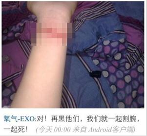 粉絲割腕圖片 粉絲割腕圖片