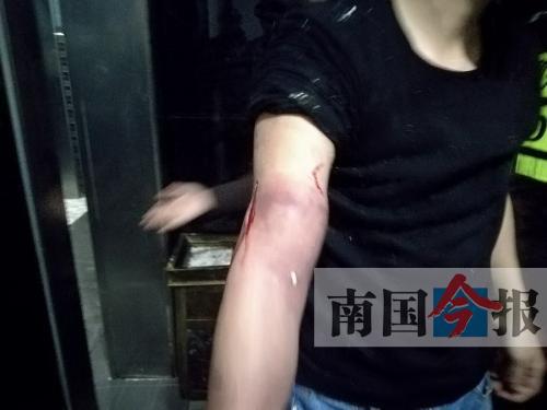 覃先生手臂被卡的部位受傷流血,所幸傷勢無大礙。 通訊員 王建民 攝