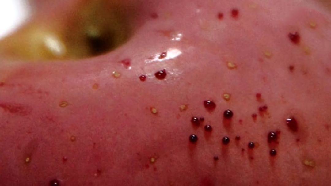 嚇懵!女子用熱水泡蘋果結果冒出血珠 咋回事? 嚇懵!女子用熱水泡蘋果結果冒出血珠 咋回事?