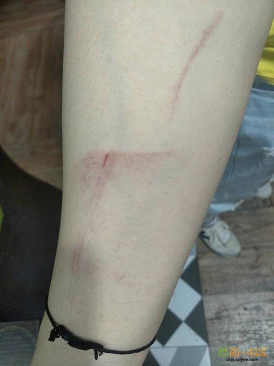 女網友舉報網帖中出示的被打后照片。