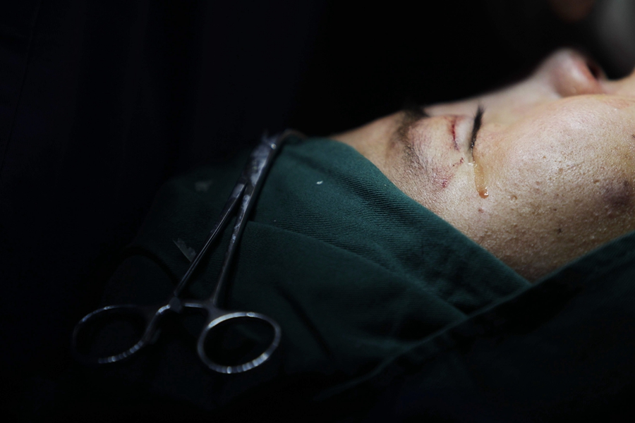 躺在手術臺上的一刻,她流下了眼淚。那里面,滿含著對美麗的忐忑和憧憬。 躺在手術臺上的一刻,她流下了眼淚。那里面,滿含著對美麗的忐忑和憧憬。