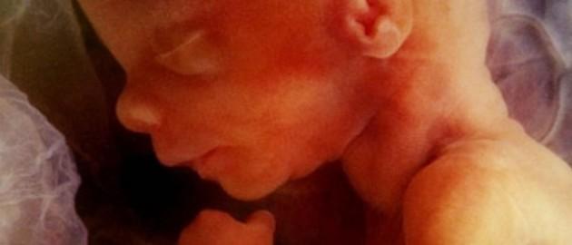 科學家研發可在子宮內為胎兒做手術機器人 科學家研發可在子宮內為胎兒做手術機器人