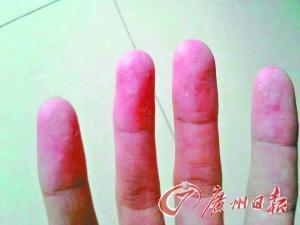 近百學生沒疊好被子遭體罰 校長:沒懲罰不叫教育