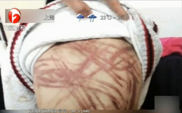 “虐童案”開庭 養母堅稱無罪