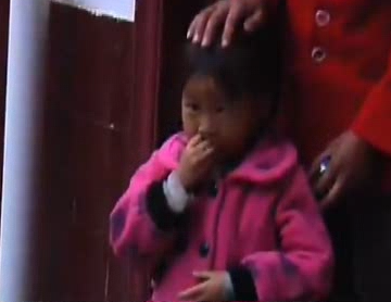 惡犬咬傷幼童 村醫開出消炎藥